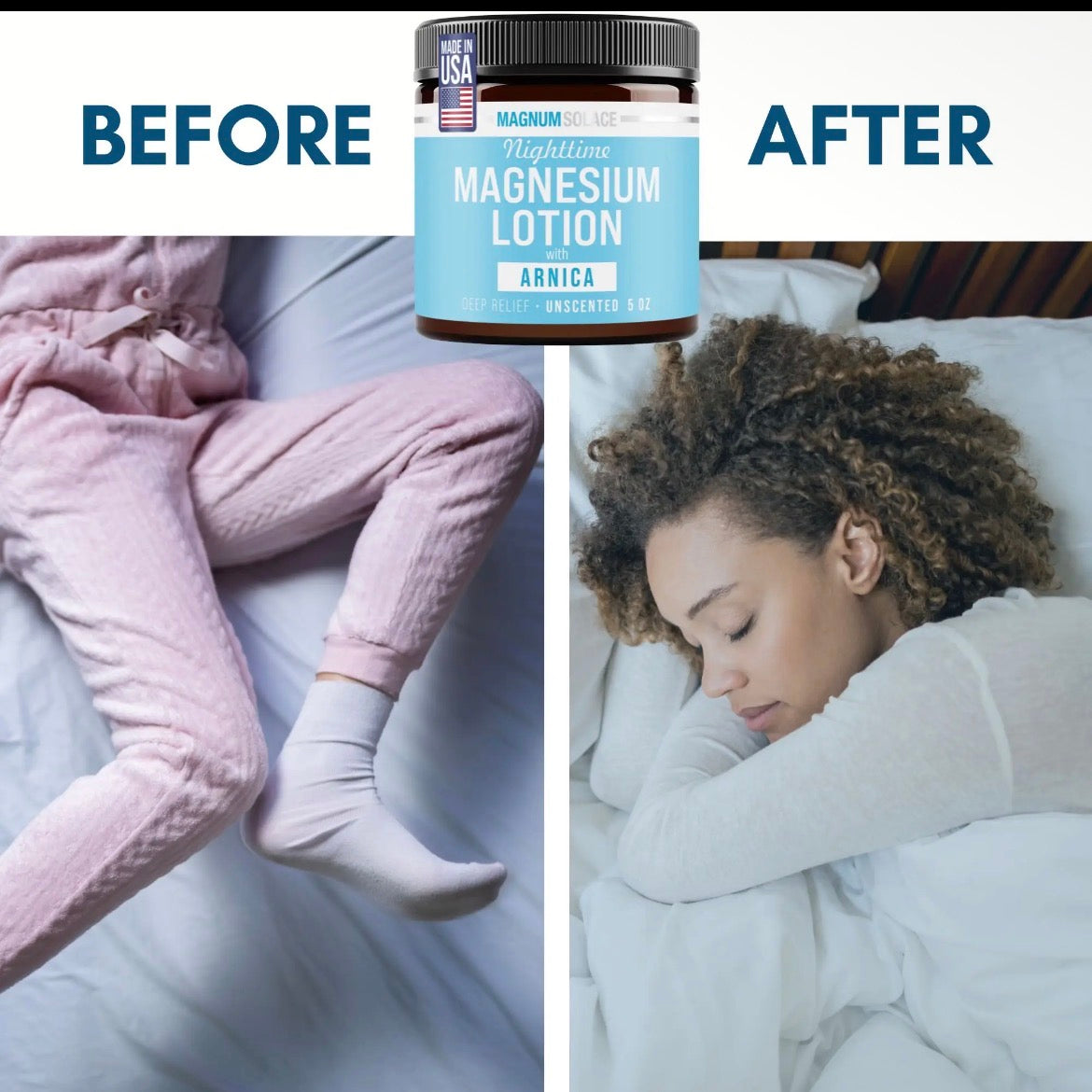 Magnesium Lotion